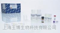 qiagen|57704|QIAampMinEluteVirus SpinKit